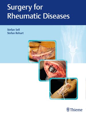 cover image of Surgery for Rheumatic Diseases
